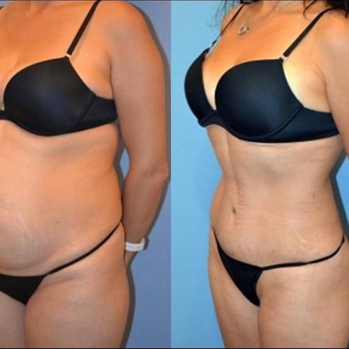 Before after photos of our patients 1